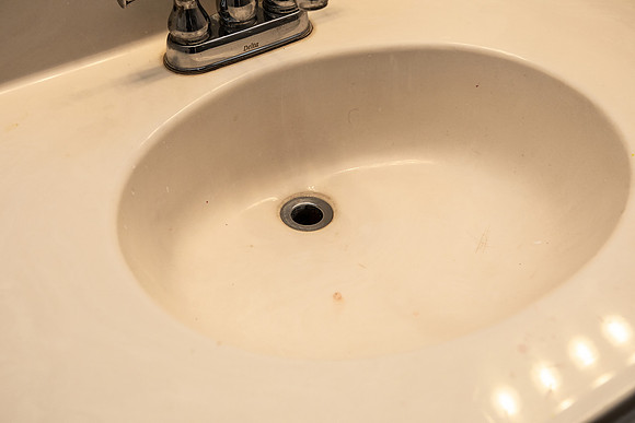 sink needs cleaning