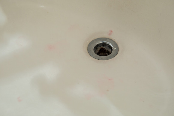 sink needs cleaning